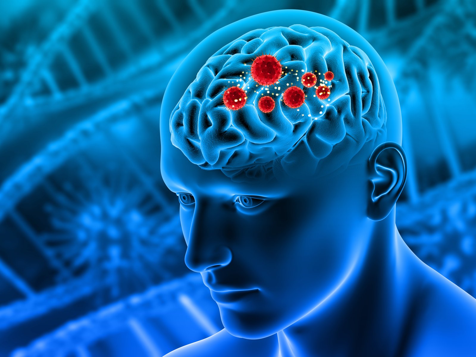 Autoimmune Neurological Conditions